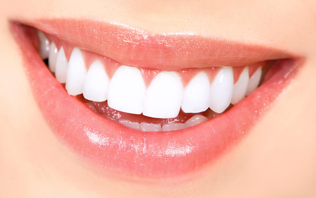 teeth whitener 